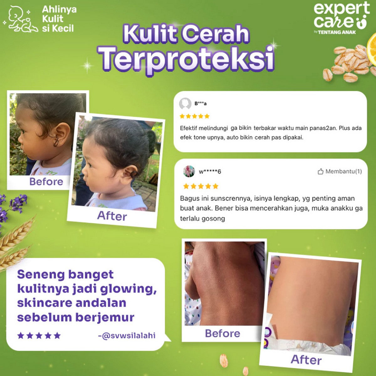 Expert Care Daily Moisturizing 50gr Physical Sunscreen SPF 50+ Proatection 50 gr Tentang Anak