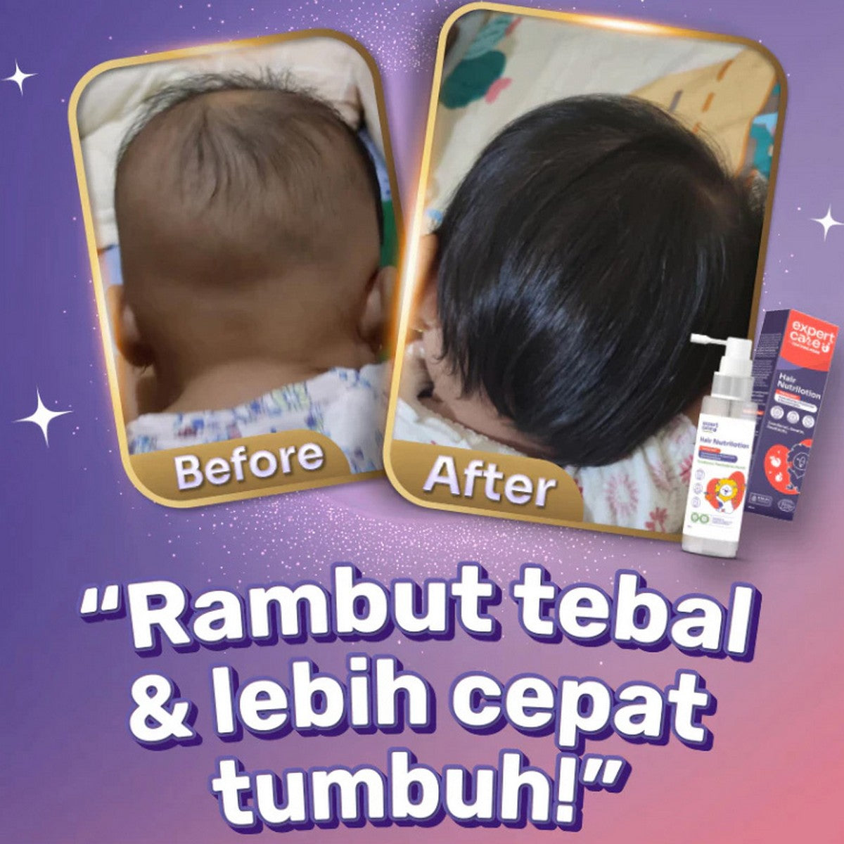 Expert Care Hair Lotion Baby Nutrilotion Peachy Fresh 100ml Rambut Bayi 100 ml Tentang Anak