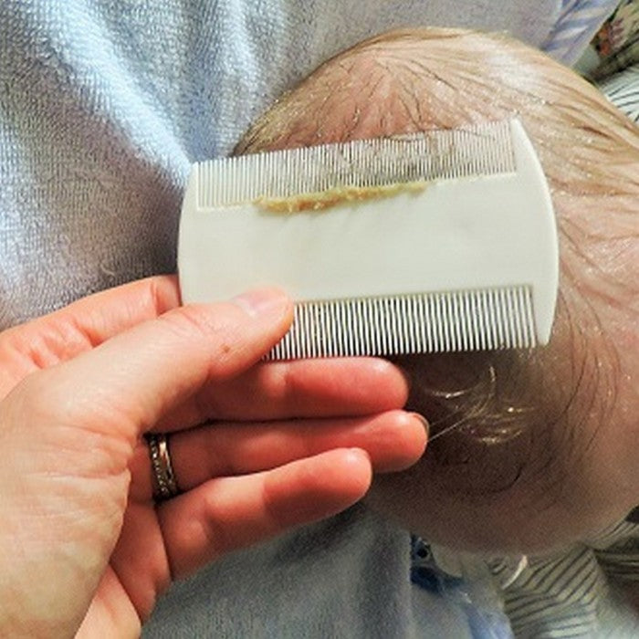CHICCO Weaning Fine Toothed Comb for Cradle Cap 0M+ Sisir Halus Bayi