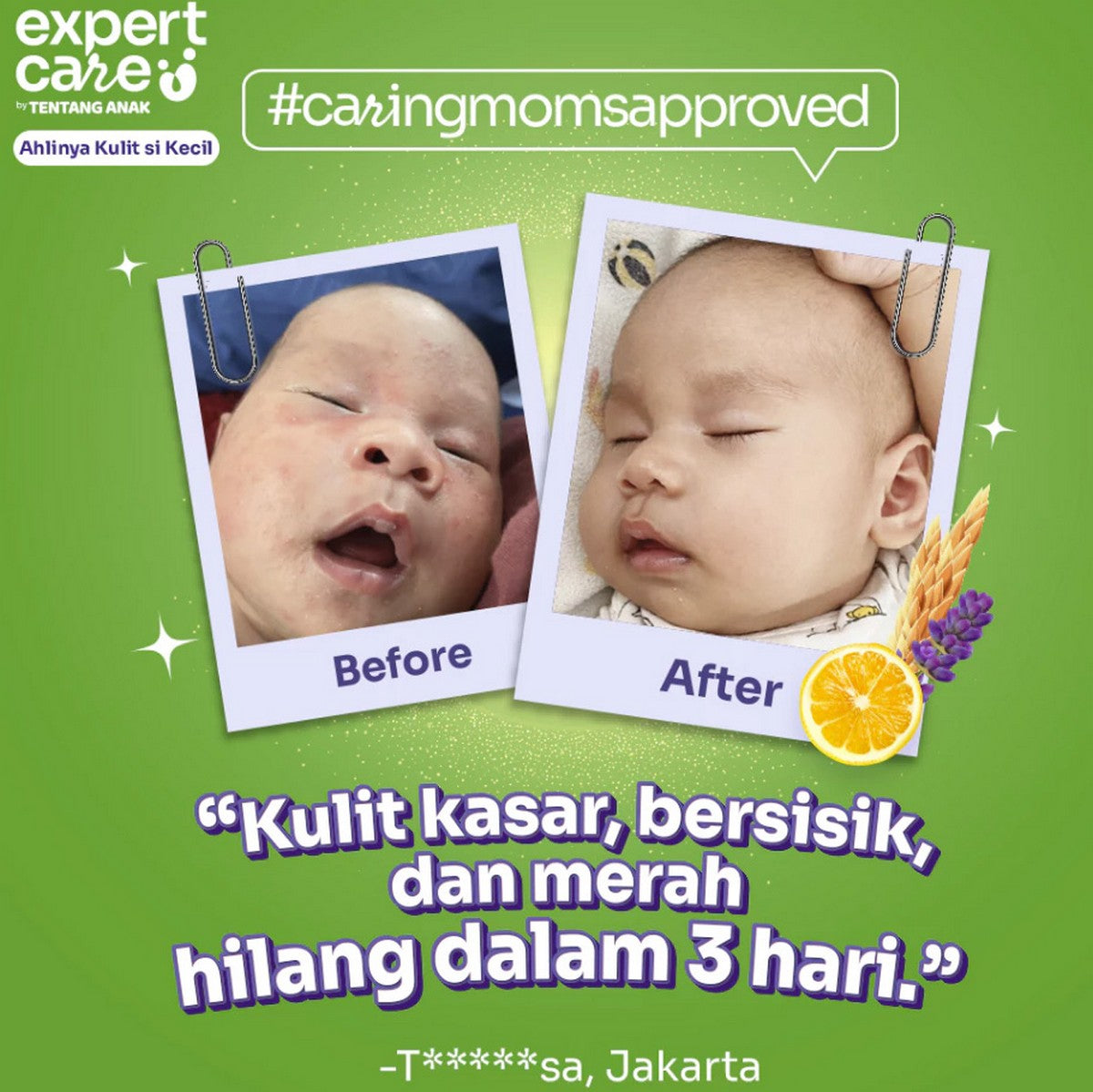 Expert Care Daily Proatect Soothing Calming Cream Baby Krim Pelembab Bayi Tentang Anak