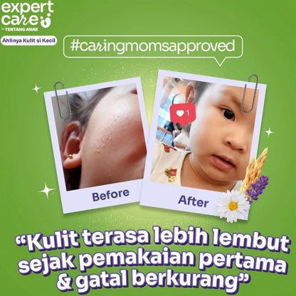 Expert Care Gentle Proatect Shampoo 250 ml Body Wash 250ml Sabun Sampo Tentang Anak 2in1