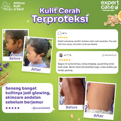 Expert Care Daily Moisturizing 50gr Physical Sunscreen SPF 50+ Proatection 50 gr Tentang Anak